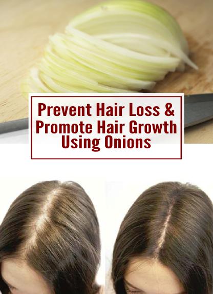 Hairstyles To Prevent Hair Loss